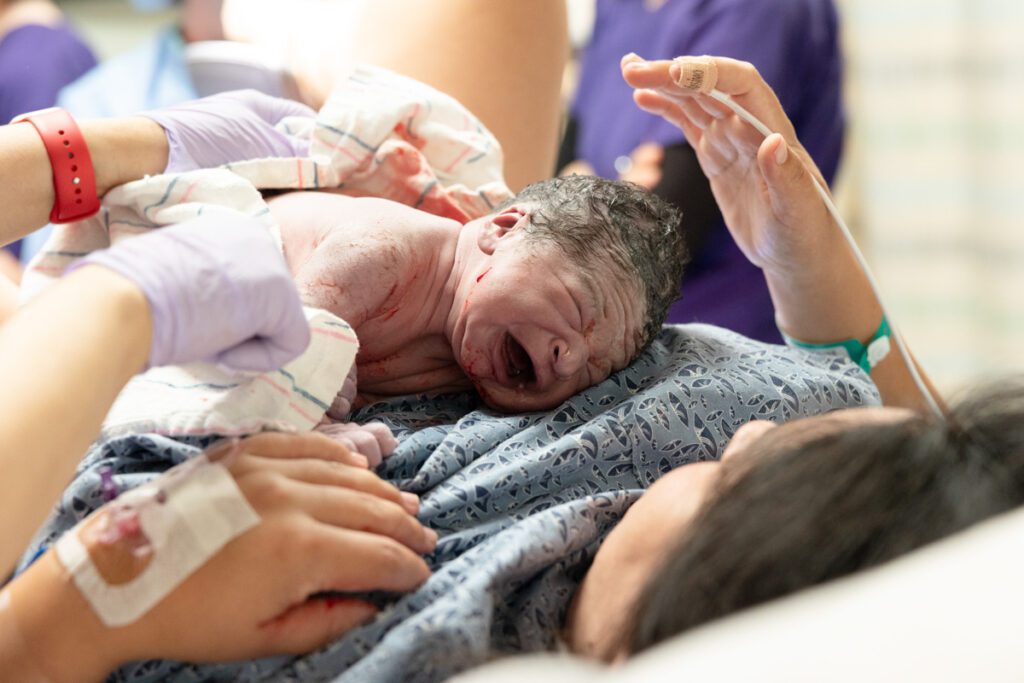 Newborn baby on mother's tummy captured by a birth photographer