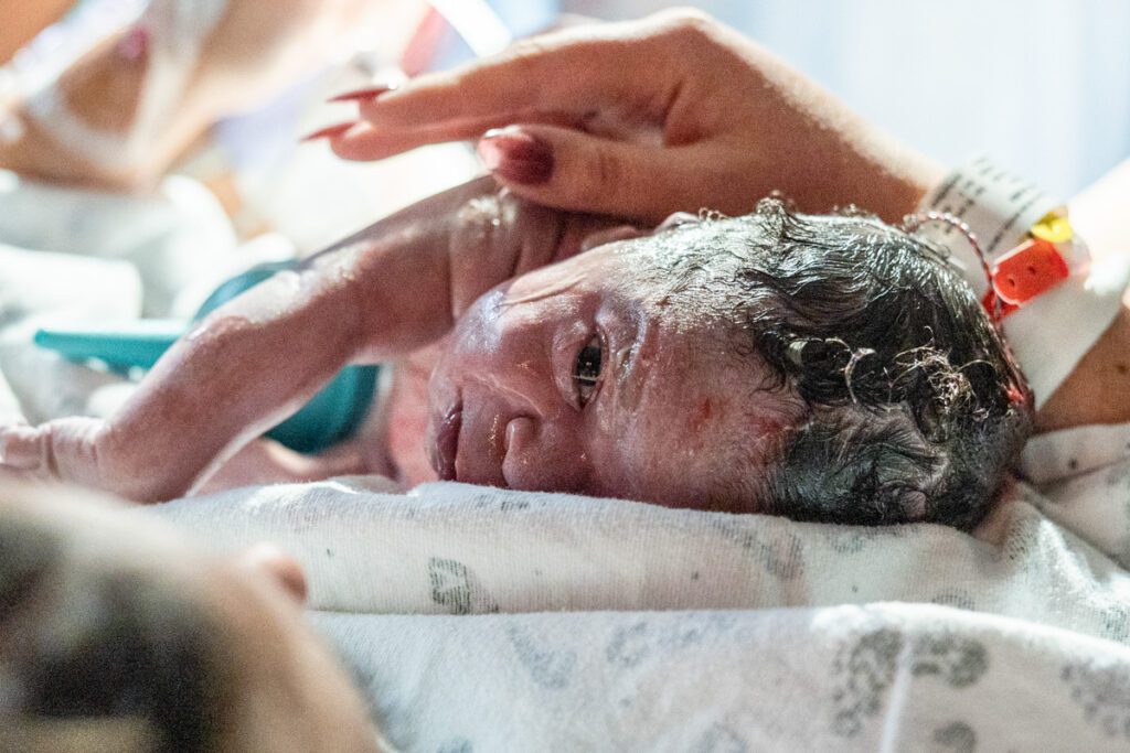 Orange county birth photographer captures a newborn baby placed on mama's tummy